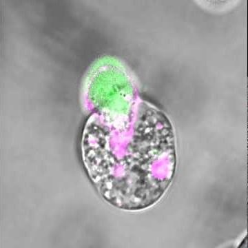 An amoeba eating a human cell