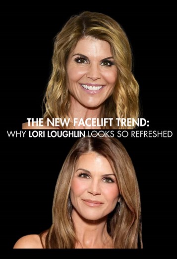 The Lori Loughlin facelift rumors 👀 This is what natural, modern facial rejuvenation looks like — natural, balanced, and undetectable. #LoriLoughlin #Facelift #FaceliftSurgery #PlasticSurgery