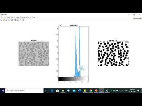 Segmentation Process Part 3: OTSU and Adaptive Threshold - Part 1 Matlab Implementation -W6