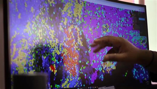 Lung cancer researchers identify 'breakthrough' patterns predictive of treatment success