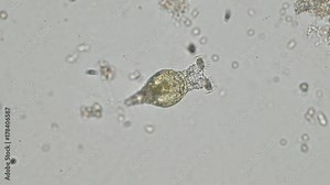 Rotifers are microscopic aquatic animals of the phylum Rotifera. Rotifers can be found in many freshwater environments and in moist soil. Stock Video