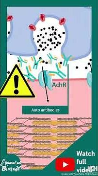Myasthenia Gravis | Quick Medical Fact | Autoimmune Disease: Myasthenia Gravis Simplified
