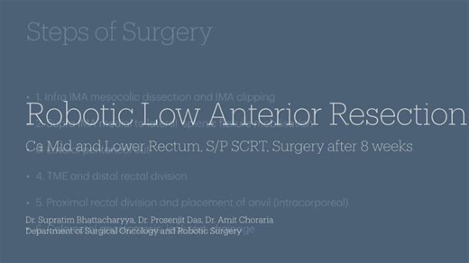Robotic Low Anterior Resection (ICG Guided   Intracorporeal Anastomosis)