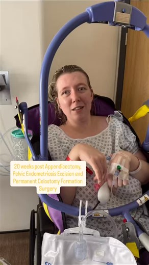 5.5K views · 14 reactions | 20 weeks since my major pelvic surgery!...