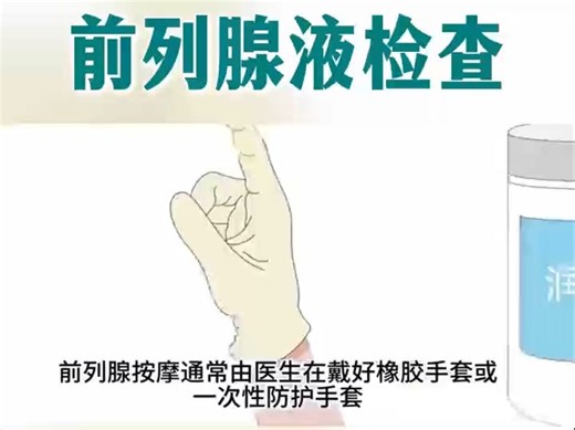 前列腺液检查