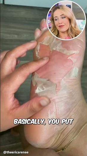 The VIRAL foot peeling mask