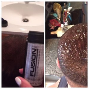 !!! Precision Kit (12gm Hair Fiber Fiber Applicator Hair Fiber Hold Spray) Best Buy: ~ www.realhairfusion.com (35% Off Coupon Code "10K") Offer Price : $39.99 🌎 Worldwide Shipping Available 🌎 INDIA (INR --750) WHATS APP 91-81688-86589 UK (POUND -- 35) WHATS APP 44 7900922650 | Real Hair Fusion