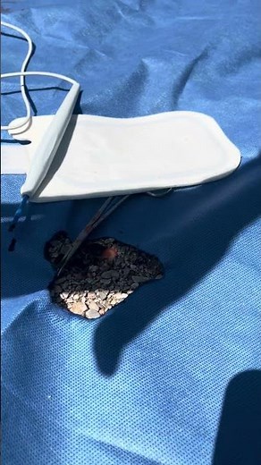 Duraprep demonstration