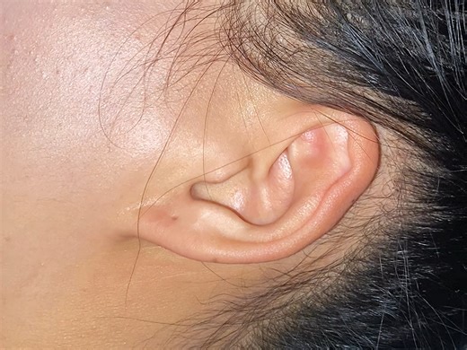 同事的钢铁耳膜嘎嘎响