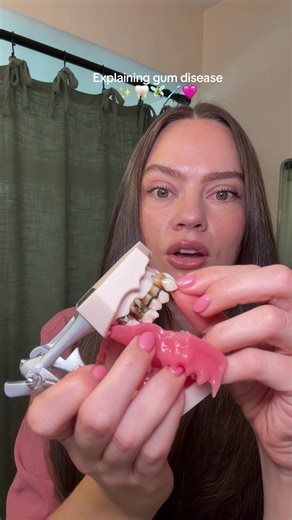 Understanding Gum Disease: A Guide for Hygienists