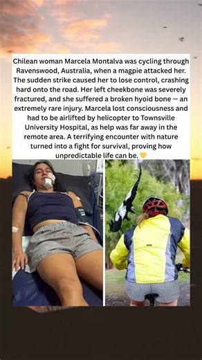 “The Magpie Attack That Changed Her Life”❤️❤️❤️