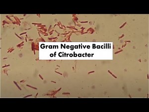 Gram Negative Bacilli of Citrobacter