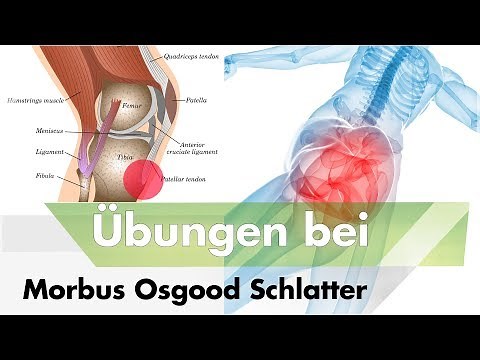 Morbus Schlatter | Diese Übungen können helfen