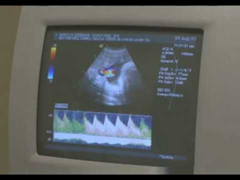 Blood Detectives Trailer