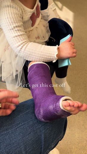 Cast Removal Day for Toddler with Broken Leg - Orthopedic Clinic Visit