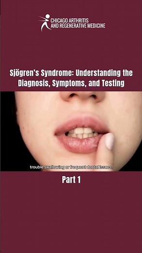 Sjögren’s Syndrome: Understanding the Diagnosis, Symptoms, and Testing 👀💧 | PART 1 #SjogrensSyndrome