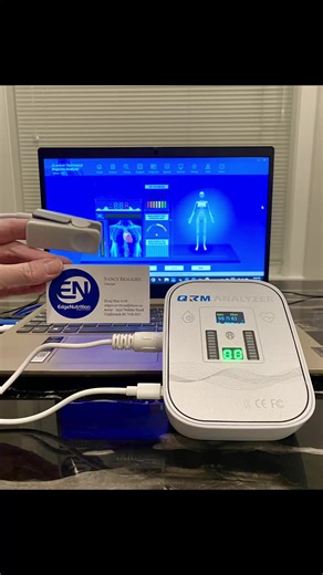 This is a Quantum Resonance Magnetic Analyzer machine. It is a powerful tool in advancing your health. I’ve scanned over 100 people now and each person sits next to me confirming many details that the test detects. I read about the areas of their health they need improvement in, and I direct them to the best course of action for them. The top three issues people have that need addressing are cardiovascular problems (the silent killer), liver problems, and bone health issues. Our bodies can repai