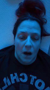 ✨Plastic Surgery Day 1✨ Follow my transformation journey on my page a... | Alex Simpson