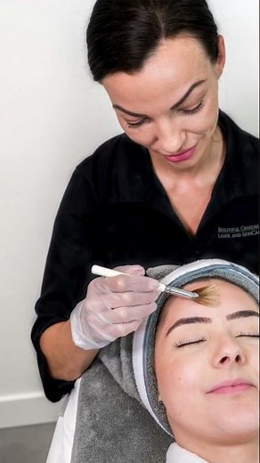 What is a Jessner Peel? #chemicalpeel #skincare #medicalaesthetics