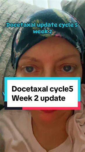 Docetaxel Cycle 5 Week 2 Update: Positivity During Treatment