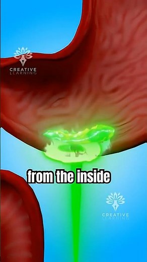 Why Doesn’t Stomach Acid Burn You? 😨 #facts #science