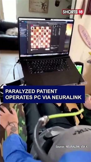Mind Over Matter: Quadriplegic Plays Chess Using Neuralink Technology #shorts | N18S