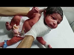 Newborn Baby Vomiting & Abdominal Distension Management | Recovery and Restart Feeding