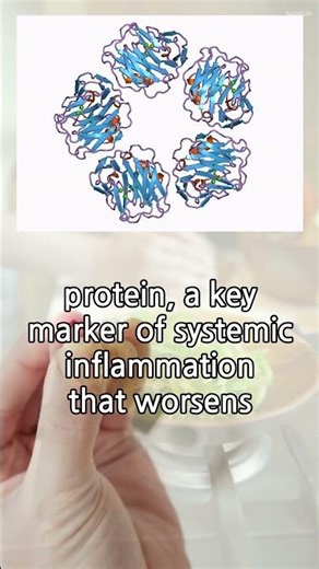 Why Muscle Loss Increases Cancer Death Risk by 2.5x
