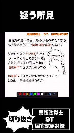27-184 嚥下障害を疑う所見 痰の増加 湿性嗄声 体重減少 食事時間の延長が挙げられる