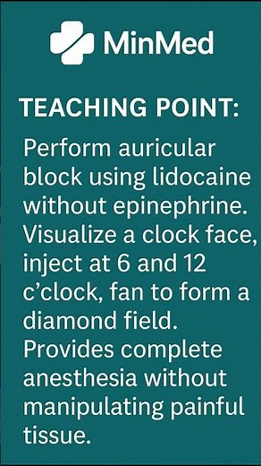 💉 Auricular Block Made Easy: Diamond Field for Painless Relief!