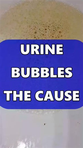 Dr. Robert G DeBease, ND, DC on Instagram: "Urine Bubbles--This is the CAUSE"