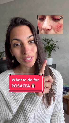In traditional Chinese medicine rosacea is caused by ‘excess heat’ in the body. For this reason we don’t want to aggravate it with facial cupping - instead, use the cups to stimulate the lymphatic system which will help to boost your immune system and balance the heat within the body. Due to its many benefits, using organic, cold-pressed prickly pear seed oil directly on the area is a great way to lower inflammation and reduce rosacea. Once it has been reduced, you can slowly begin to cup over t