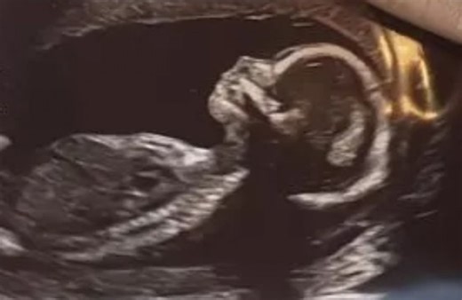 Cher Lloyd reveals she's pregnant with second child
