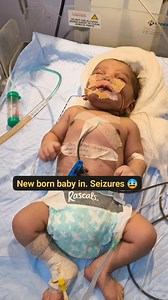 #What Are Infant Seizures? How Do I Know If My Baby Is Siezing?Newborn seizure symptoms are often subtle, including rapid eyelid blinking, staring, eye rolling, lip smacking, chewing, tongue thrusting, bicycling leg movements, body stiffening, or pauses in breathing (apnea) | Aman Kumar