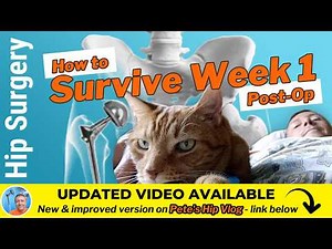 How to survive the ROUGH FIRST WEEK after Total Hip Replacement