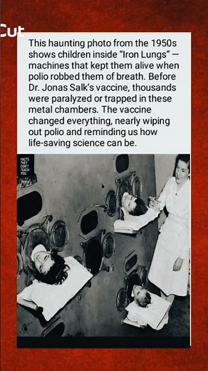 Polio’s Prison: The Iron Lung Story
