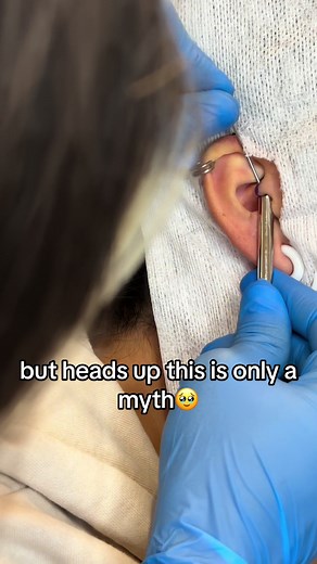 Relief from Migraines with Daith Piercing in Dubai