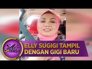 Elly Sugigi Tampil Dengan Gigi Baru - Seleb On News (20/15)