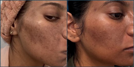 I Tested out the Viral K-Beauty Brand, Medicube. Here's What I Really Think