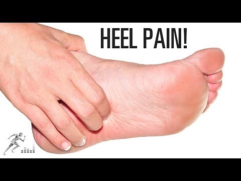 Plantar fasciitis: Signs, symptoms and treatment options