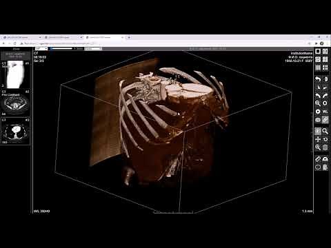 DICOM Web-viewer