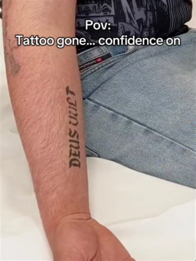 Tattoo removal is a medical procedure, performed in a Ministry of Health licensed Medical Laser Center, using FDA-approved medical laser devices, and following approved medical protocols under doctor supervision. We use advanced PicoSecond technology for medical tattoo removal, designed to target ink particles precisely while preserving surrounding skin. Treatment plans are selected based on ink type, depth, color, and medical evaluation to ensure safe and progressive removal. Medical tattoo rem