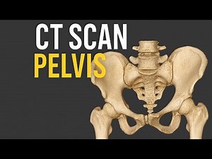 How did you make this || 3D reconstruction Ct Scan Pelvis || Ge 32 revolution machine