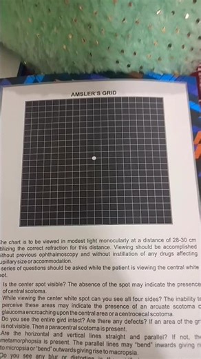 Amsler's Grid Test Chart ,central visual field ,Metamorphopsia#youtubeshorts