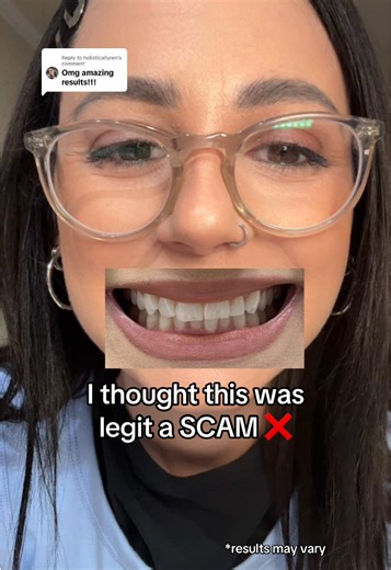 Transform Your Smile Pain-Free with Doctor Dent's Whitening Strips