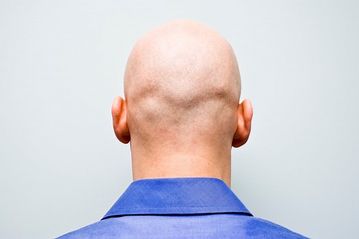 New Study Identifies Root Cause of Hair Loss