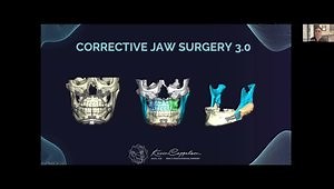 Innovative Surgical Techniques for Corrective Jaw Surgery