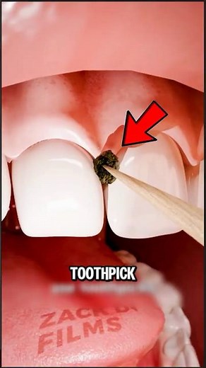 The Truth About Toothpicks That Most People Don't Know 😳🦷