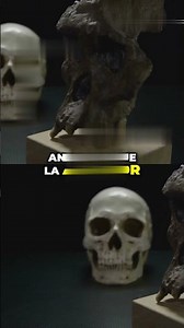 ​STARCHILD: Sus Huesos IMPOSIBLES y Características Extrañas 🤯 #shorts