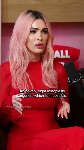 Megan Fox Sets Record Straight On Plastic Surgery She’s Had Done